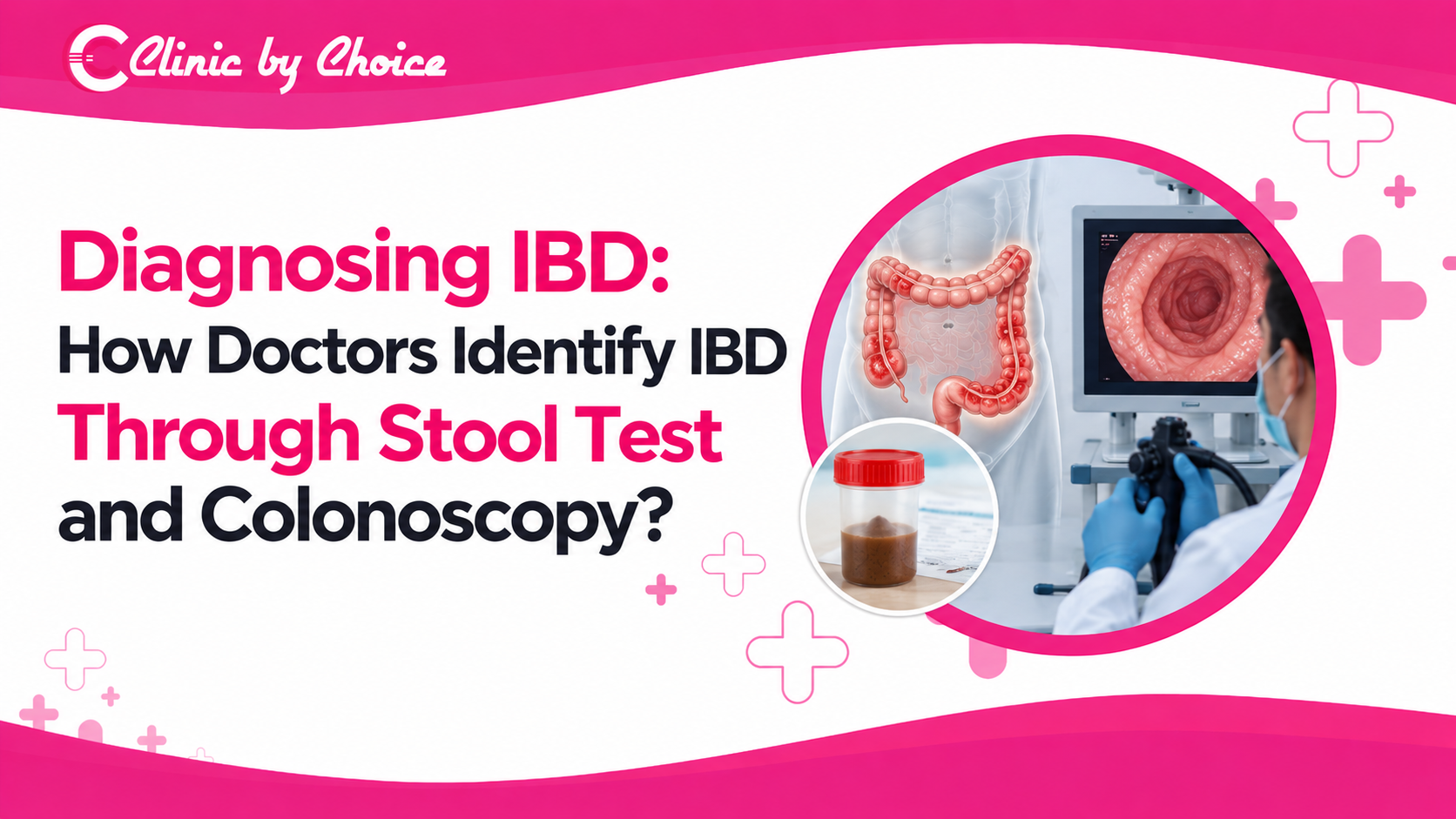 Diagnosing IBD: How Doctors Identify IBD Through Stool Test and Colonoscopy? 