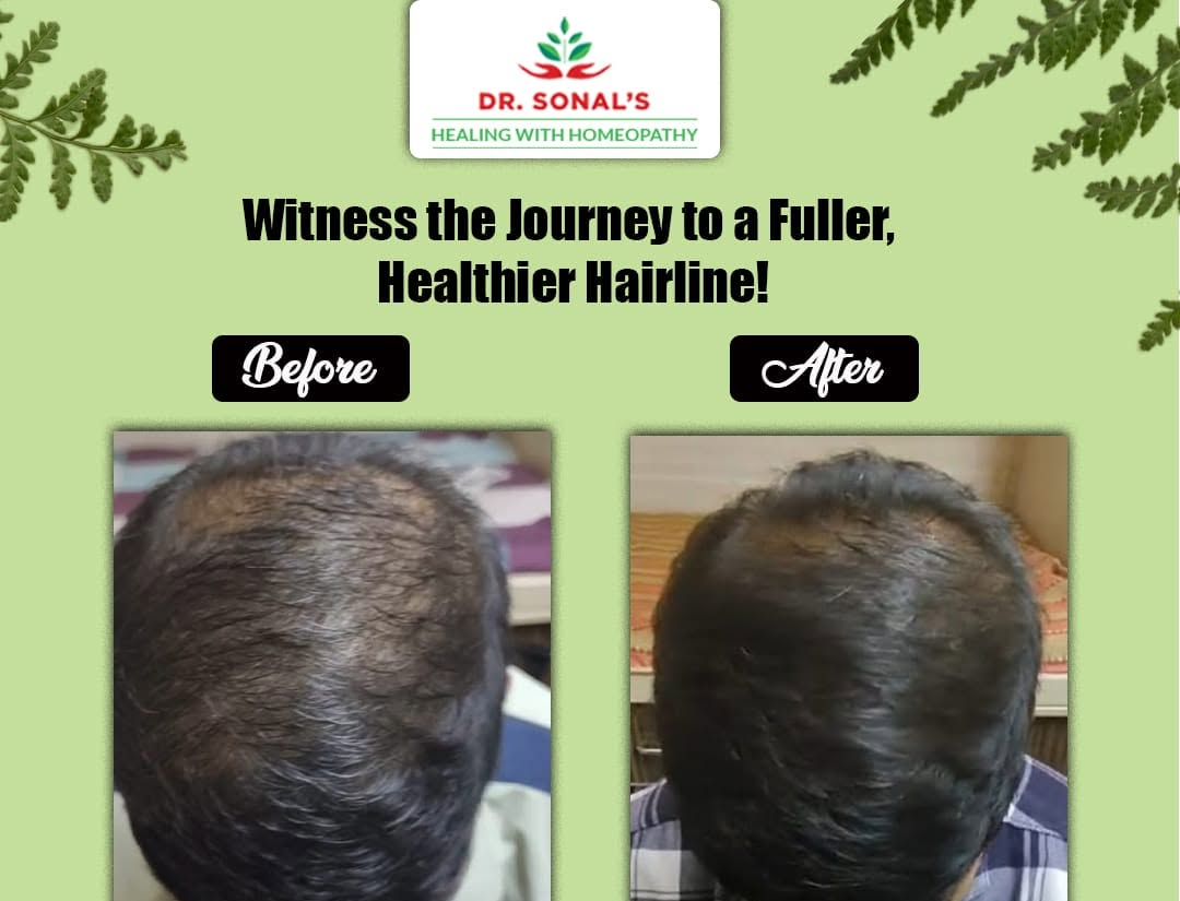 Dr. Sonal's Homeopathic Clinic Hairfall treatment (1)