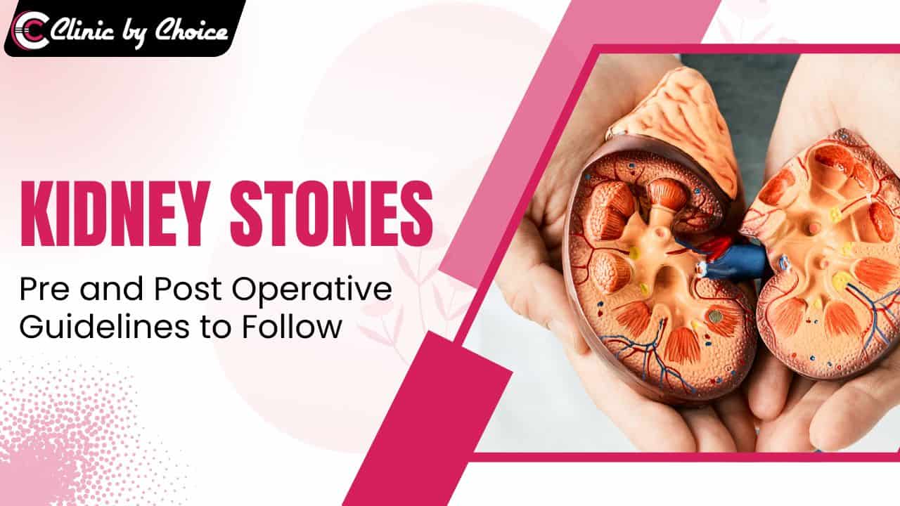 Kidney Stones: Pre and Post Operative Guidelines to Follow