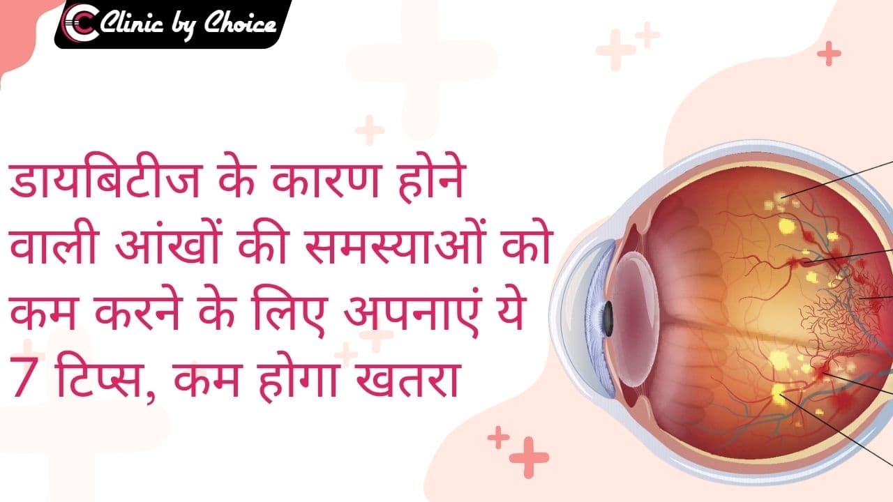 डायबिटीज के कारण होने वाली आंखों की समस्याओं को कम करने के लिए अपनाएं ये 7 टिप्स, कम होगा खतरा