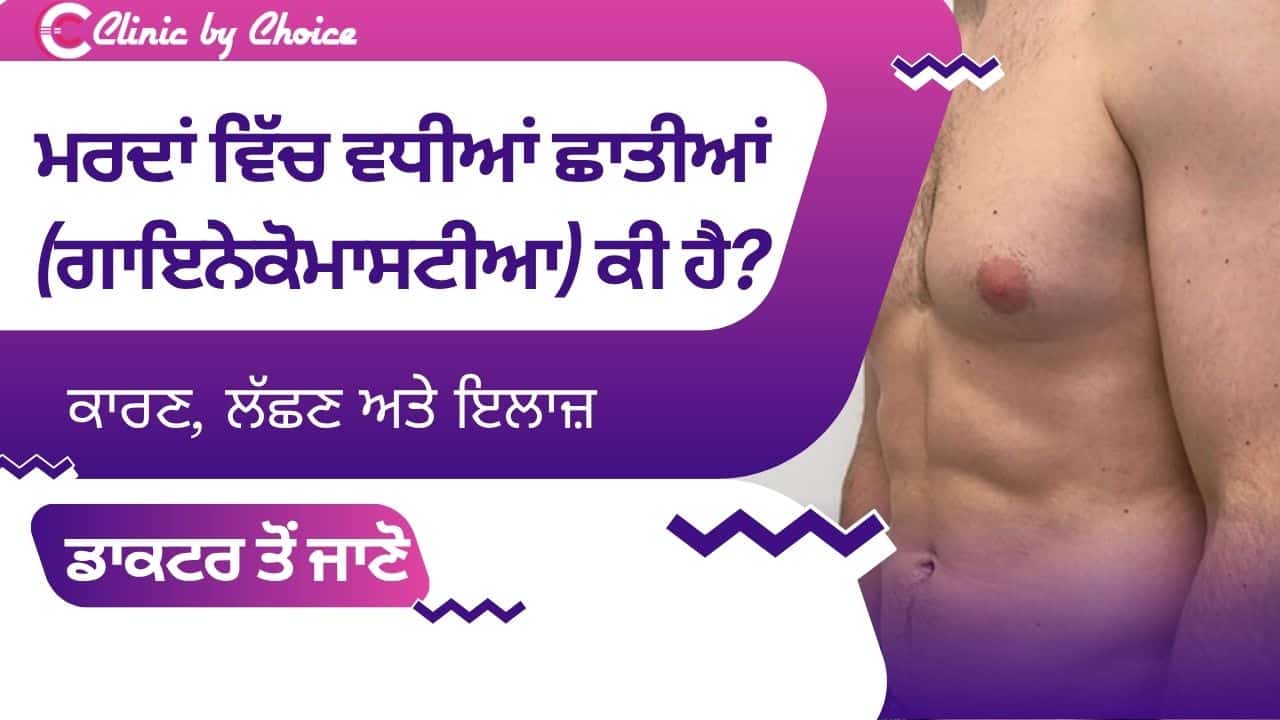 ਮਰਦਾਂ ਵਿੱਚ ਵਧੀਆਂ ਛਾਤੀਆਂ (ਗਾਇਨੇਕੋਮਾਸਟੀਆ) ਕੀ ਹੈ? ਕਾਰਣ, ਲੱਛਣ ਅਤੇ ਇਲਾਜ਼। ਡਾਕਟਰ ਤੋਂ ਜਾਣੋ