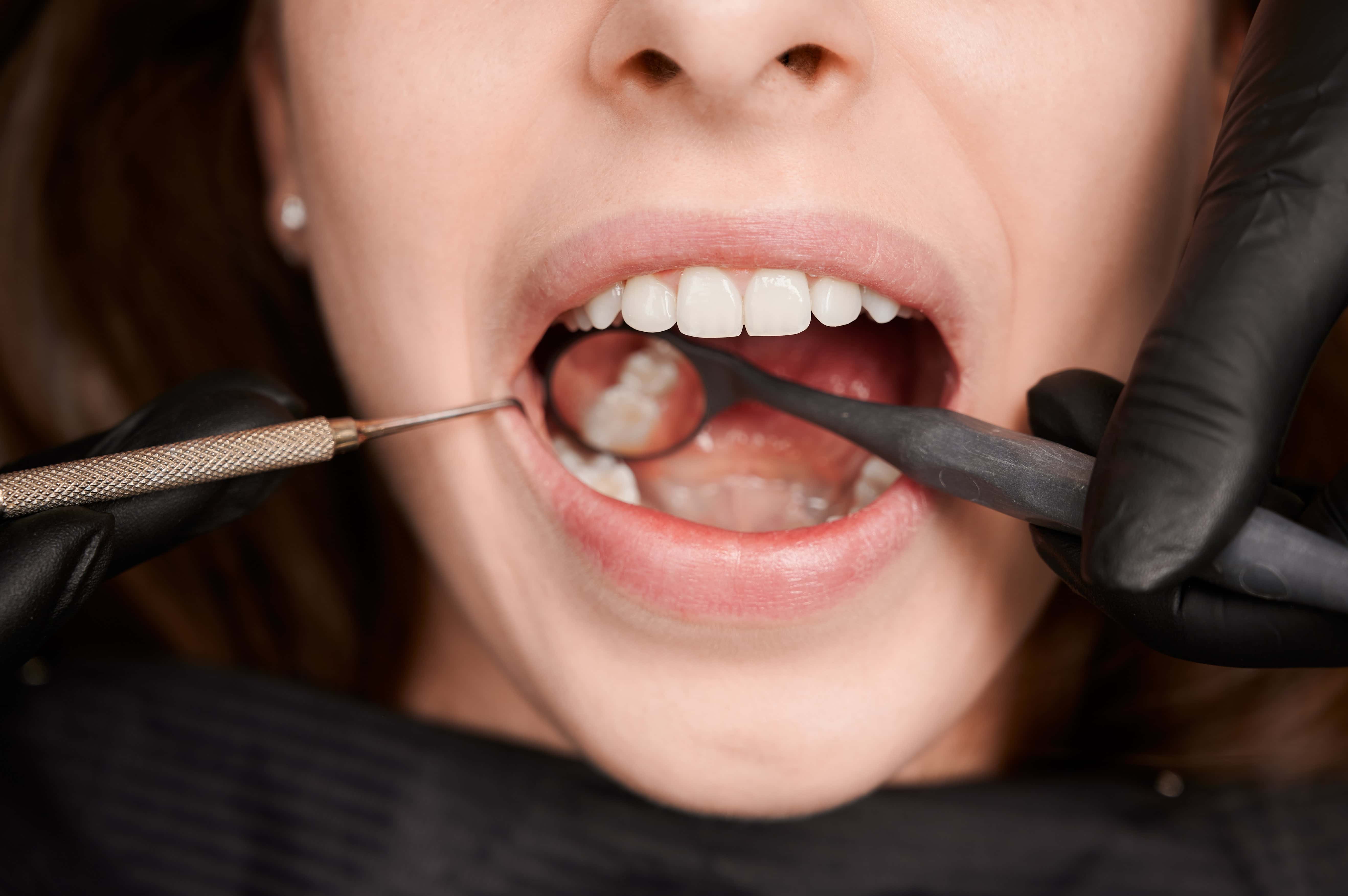 Top Tips to Enhance Your Oral Hygiene Routine