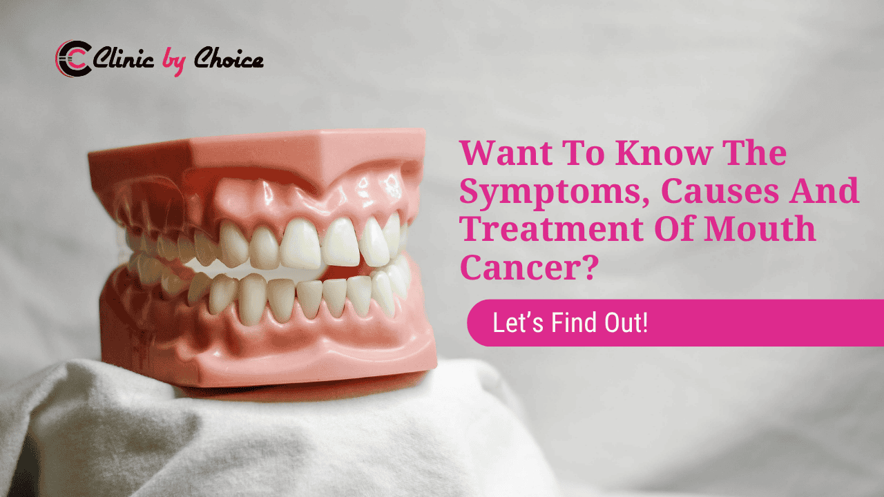 Want To Know The Symptoms, Causes And Treatment Of Mouth Cancer? Let’s Find Out!